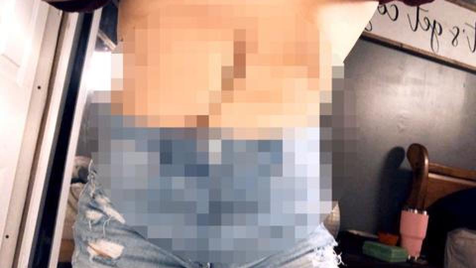 Ужас: Безопасен колан разпори корема на жена при катастрофа СНИМКИ 18+