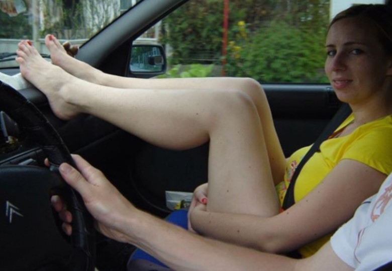 Млада жена остана саката за цял живот заради навика си да се вози в колата с крака на арматурното табло
